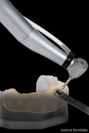 Implant Surgical Guides